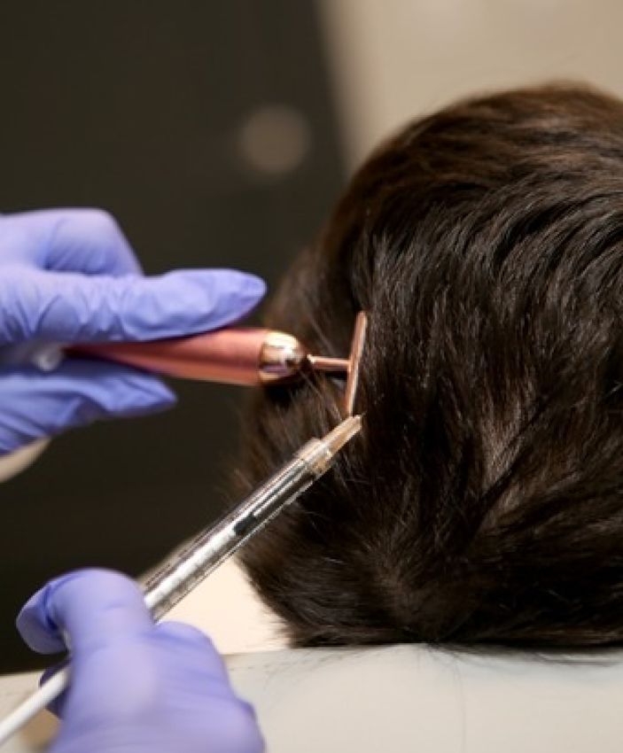 Crown Point Injectable Treatments model receiving prp hair restoration 